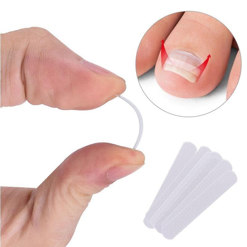 10pcs Ingrown Toenail Correction Patch Sticker - Ammpoure Wellbeing