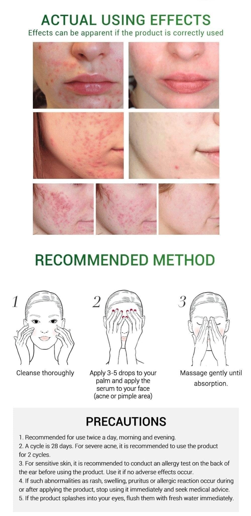 72 Pimple Acne Patches - Ammpoure Wellbeing