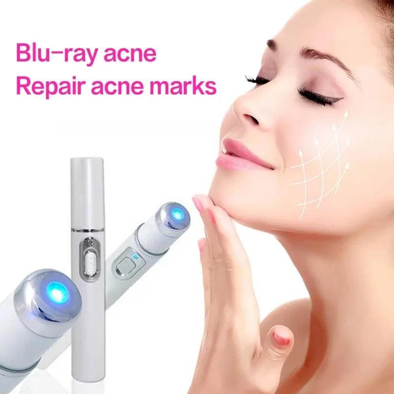 Blue Light Facial Machine Acne Wrinkle Removal Laser Pen Skin Spots Removal Anti Varicose Spider Vein Eraser Medical Treatment - Ammpoure Wellbeing