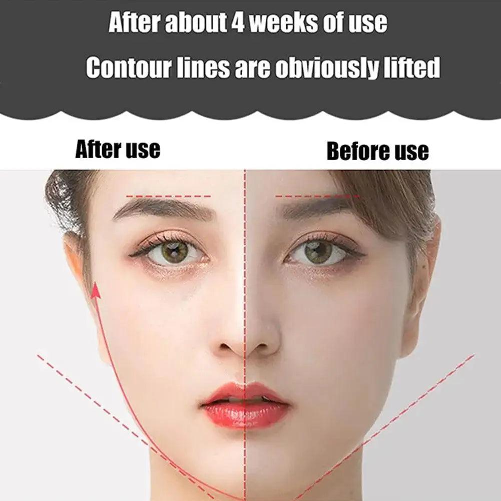 EMS Face Massager Roller Y Shape Face Lifting Device V Face Double Chin Remover Face Care Skin Care Home Use Beauty Tool - Ammpoure Wellbeing