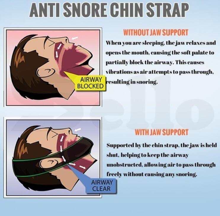 Neoprene Anti Snore Stop Snoring Chin Strap Belt Anti Apnea (black) - Ammpoure Wellbeing