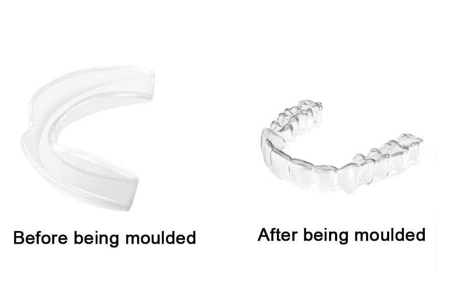 Pack of 4 Teeth Grinding Night Protector Athletic Mouth Guard Professional Dental Night Guard - Ammpoure Wellbeing