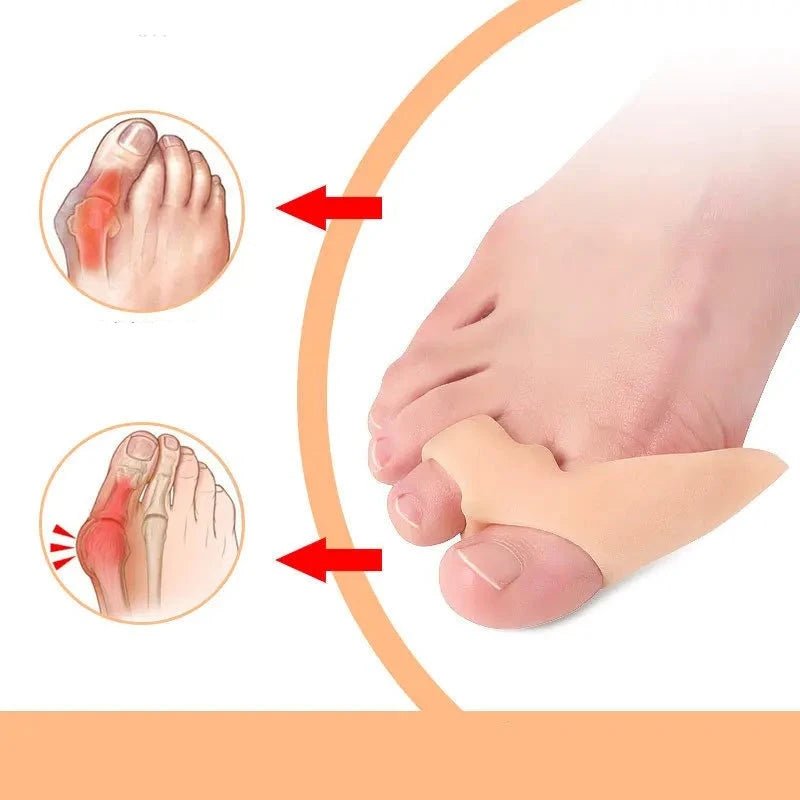 Silicone Gel 2pcs Thumb Corrector Bunion Little Toe Protector Separator Hallux Valgus Finger Straightener Foot Care Relief Pads - Ammpoure Wellbeing