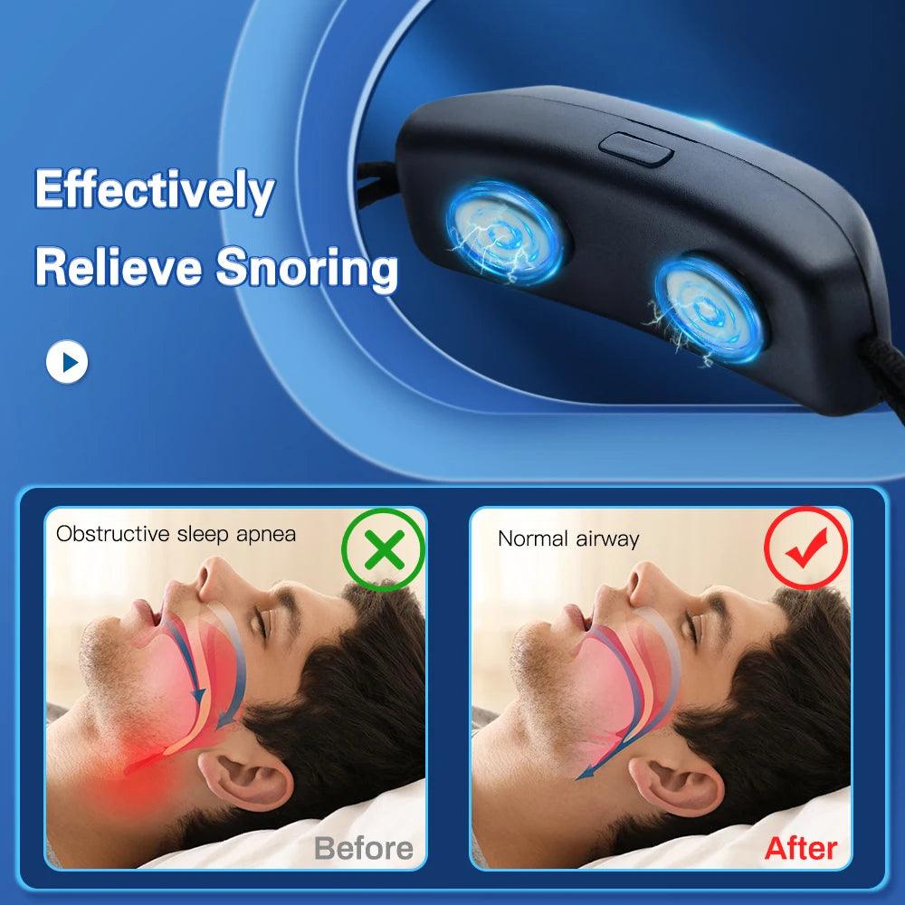 Smart Anti Snoring Device EMS Pulse Stop Snore Portable Comfortable Sleep Well Stop Snore Health Care Sleep Apnea Aid USB - Ammpoure Wellbeing